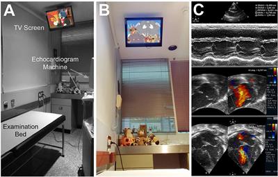 Effects of Watching Cartoons During an Echocardiography on Infants and Preschool Children. A Prospective Randomized Study